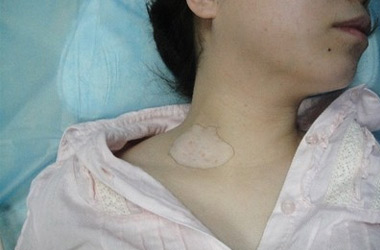 武汉白斑医院：女性白斑患者可不可以化妆?